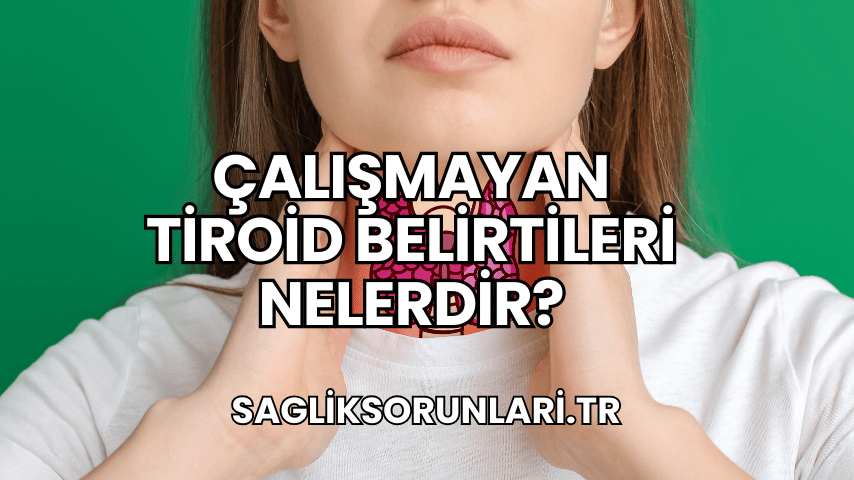 Çalışmayan Tiroid Belirtileri Nelerdir?