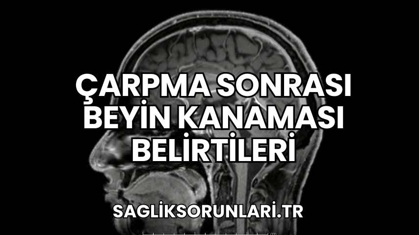 Çarpma Sonrası Beyin Kanaması Belirtileri