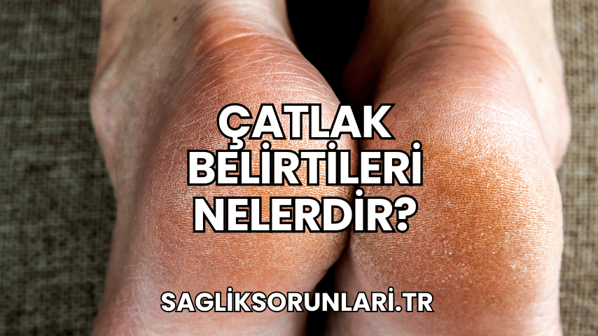 Çatlak Belirtileri Nelerdir?