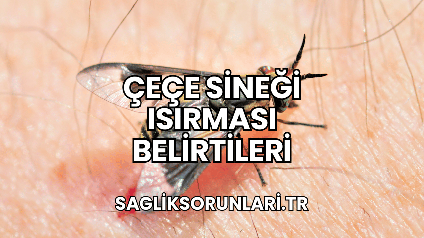 Çeçe Sineği Isırması Belirtileri