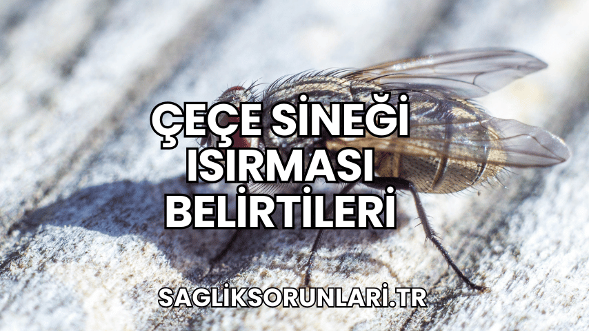 Çeçe Sineği Isırması Belirtileri