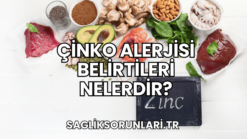 Çinko Alerjisi Belirtileri Nelerdir?