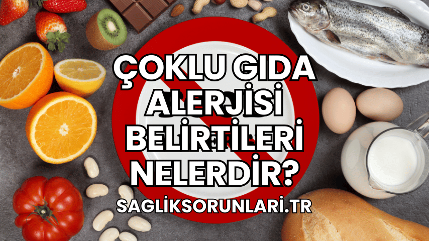 Çoklu Gıda Alerjisi Belirtileri Nelerdir?