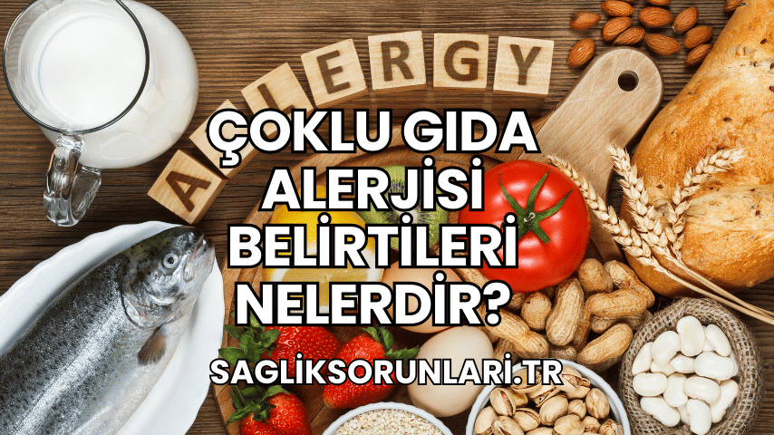 Çoklu Gıda Alerjisi Belirtileri Nelerdir?