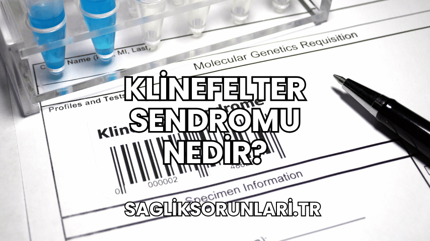 Klinefelter Sendromu Nedir?