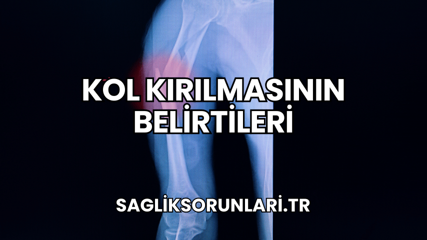 Kol Kırılmasının Belirtileri