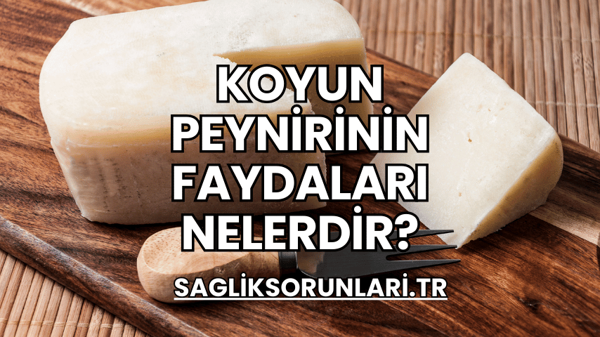 Koyun Peynirinin Faydaları Nelerdir?