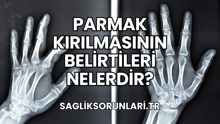 Parmak Kırılmasının Belirtileri Nelerdir?