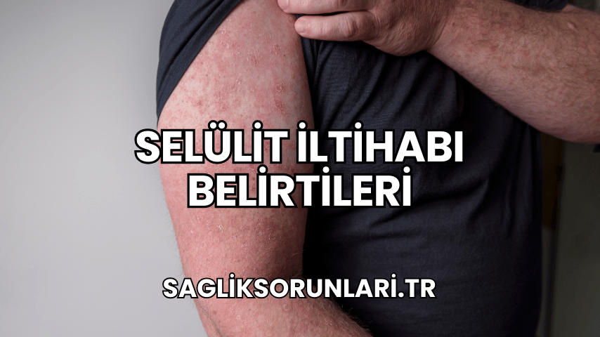 Selülit İltihabı Belirtileri