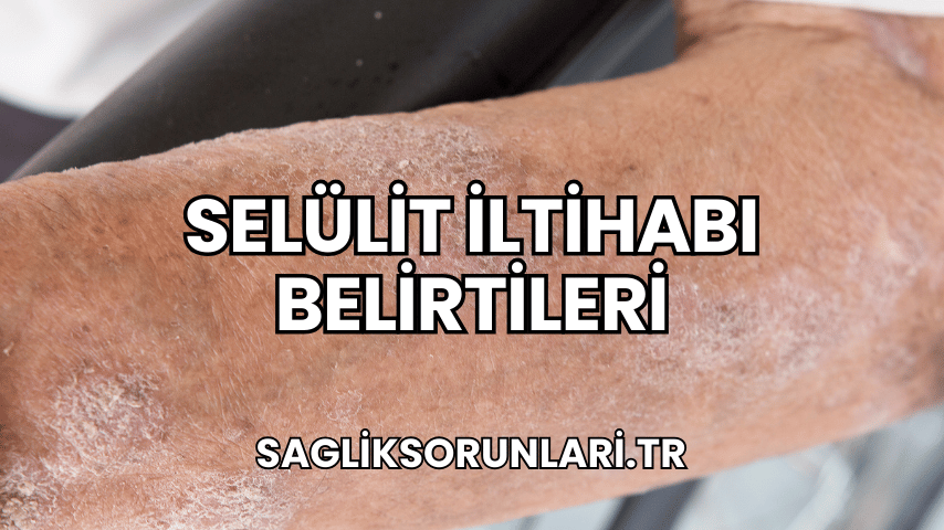 Selülit İltihabı Belirtileri