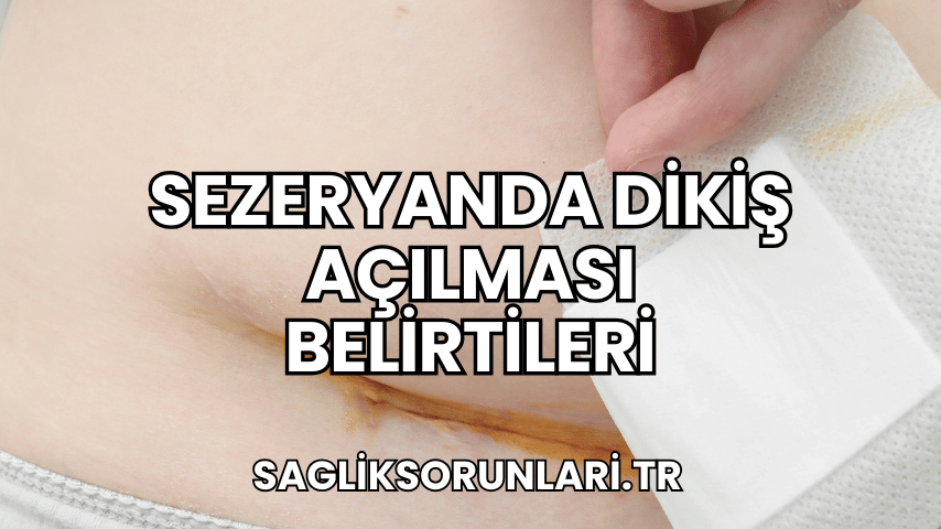 Sezeryanda Dikiş Açılması Belirtileri