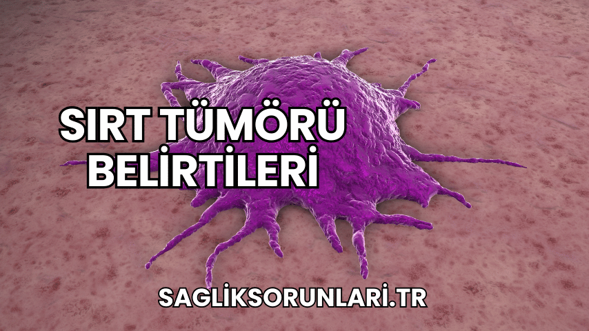 Sırt Tümörü Belirtileri