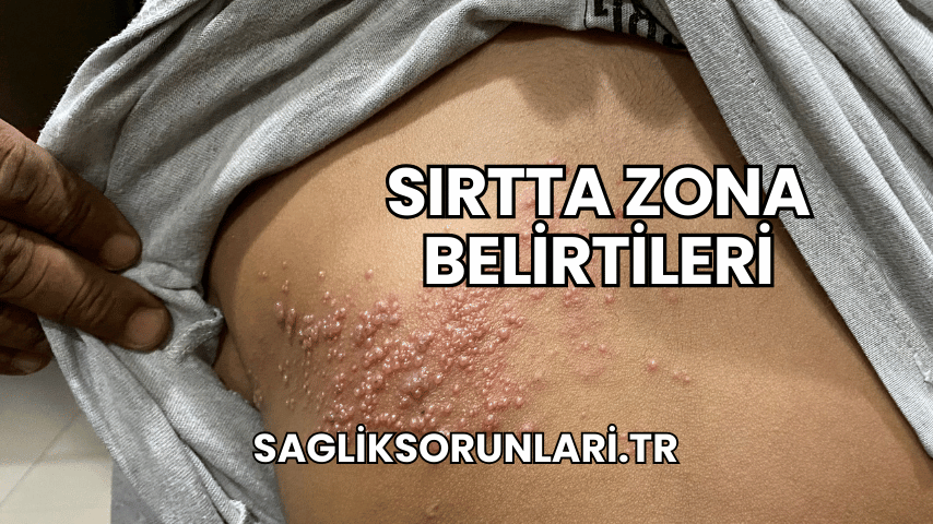 Sırtta Zona Belirtileri