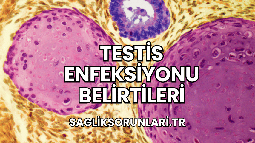 Testis Enfeksiyonu Belirtileri