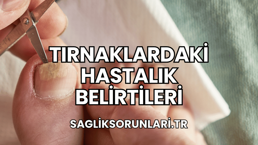 Tırnaklardaki Hastalık Belirtileri