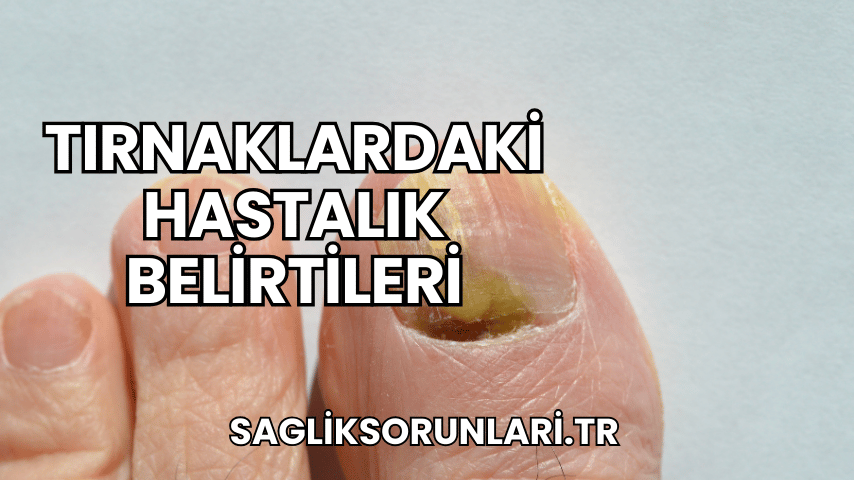 Tırnaklardaki Hastalık Belirtileri