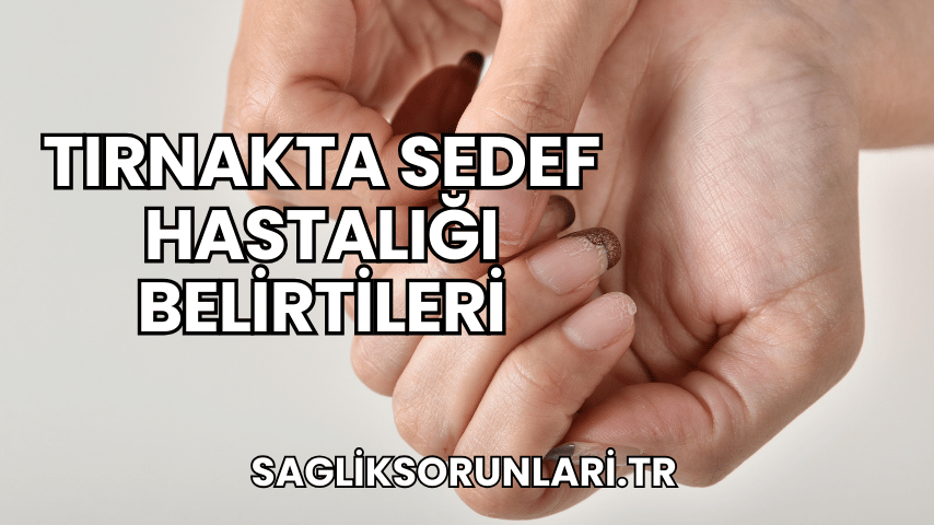 Tırnakta Sedef Hastalığı Belirtileri