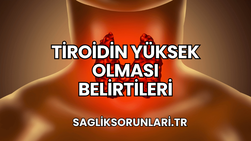 Tiroidin Yüksek Olması Belirtileri