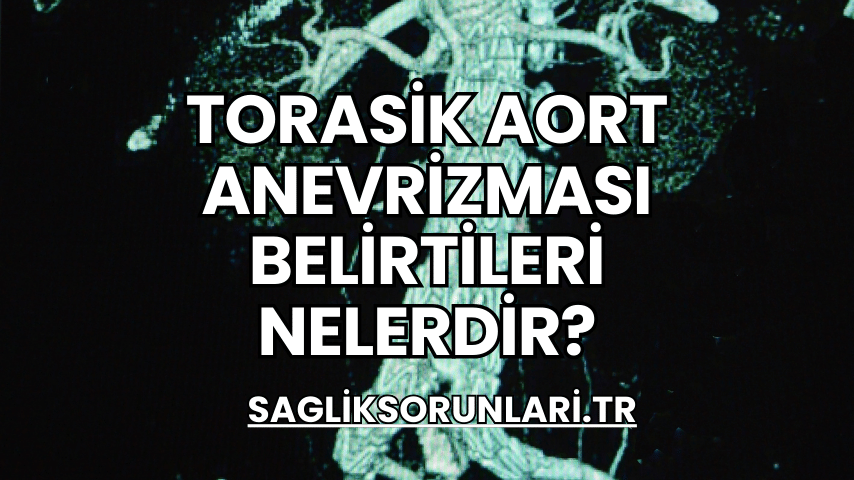 Torasik Aort Anevrizması Belirtileri Nelerdir?