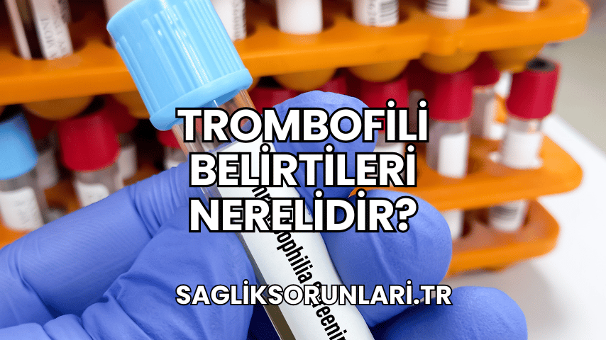 Trombofili Belirtileri Nerelidir?