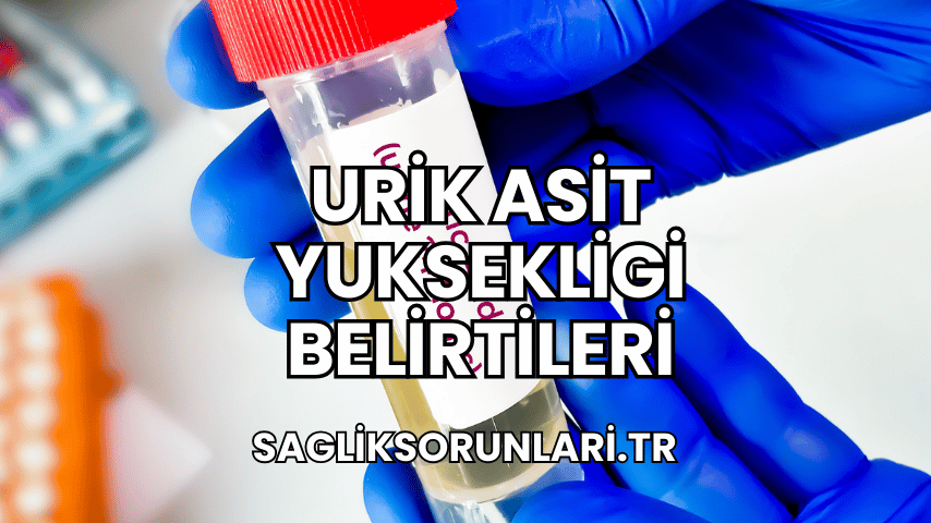 Urik Asit Yuksekligi Belirtileri