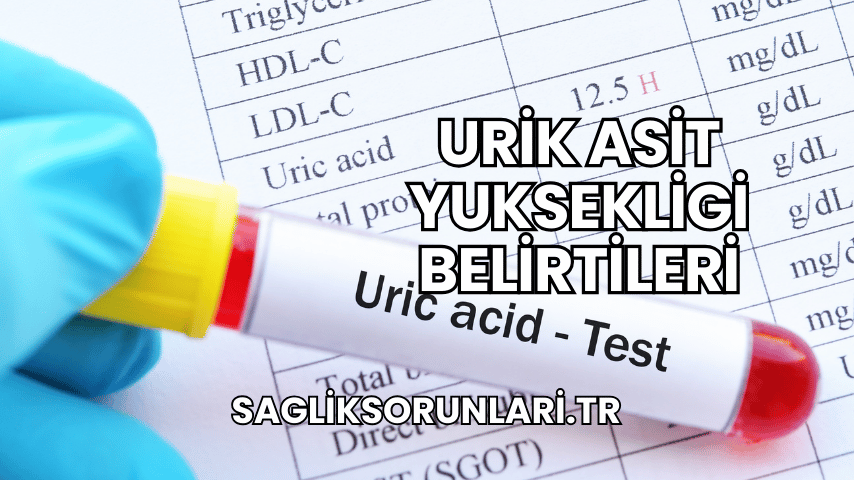 Urik Asit Yuksekligi Belirtileri