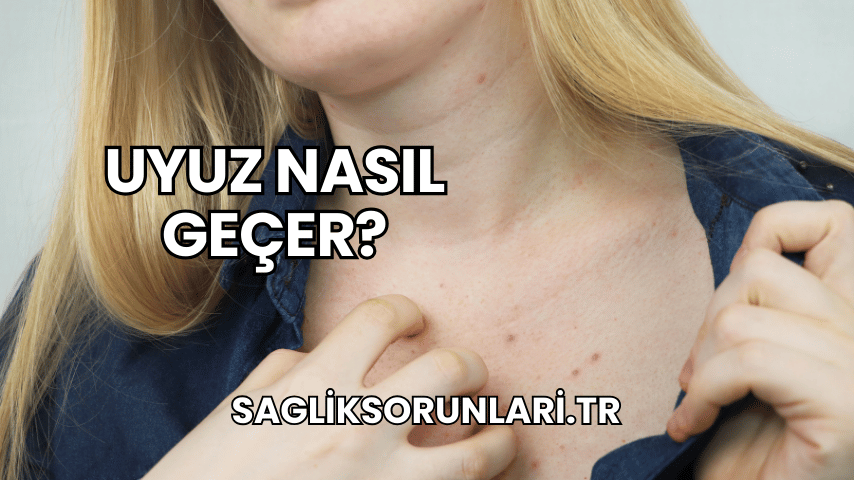 Uyuz Nasıl Geçer?