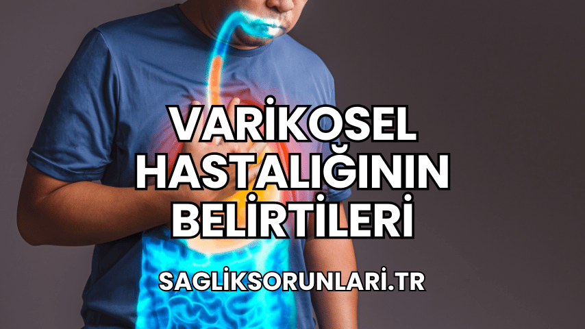 Varikosel Hastalığının Belirtileri