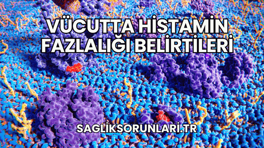 Vücutta Histamin Fazlalığı Belirtileri