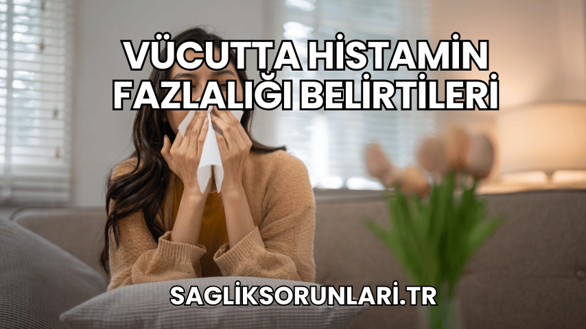 Vücutta Histamin Fazlalığı Belirtileri