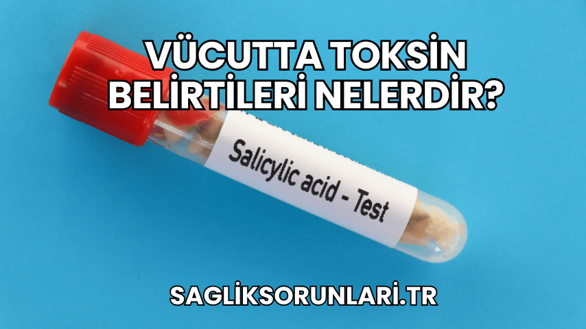 Vücutta Toksin Belirtileri Nelerdir?