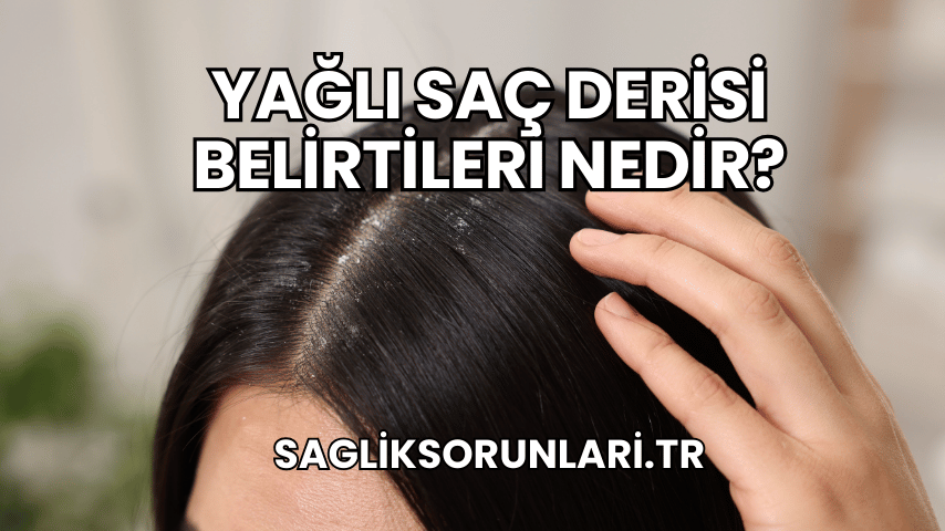 Yağlı Saç Derisi Belirtileri Nedir?