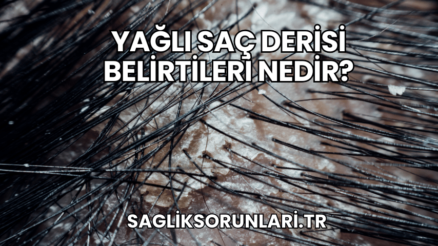 Yağlı Saç Derisi Belirtileri Nedir?