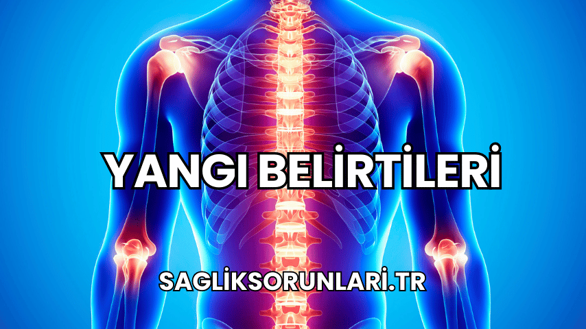 Yangı Belirtileri