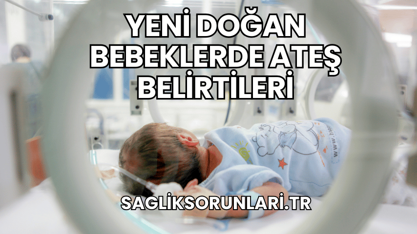 Yeni Doğan Bebeklerde Ateş Belirtileri