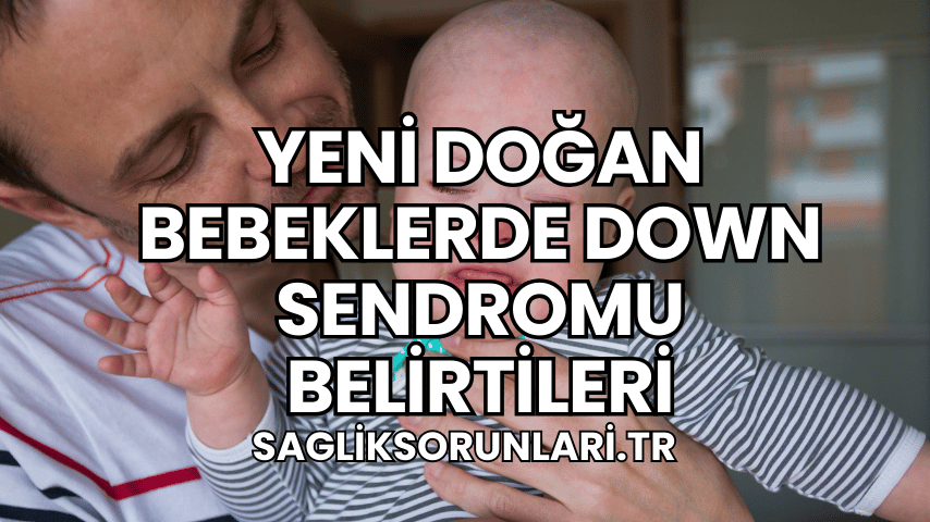 Yeni Doğan Bebeklerde Down Sendromu Belirtileri