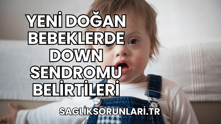 Yeni Doğan Bebeklerde Down Sendromu Belirtileri