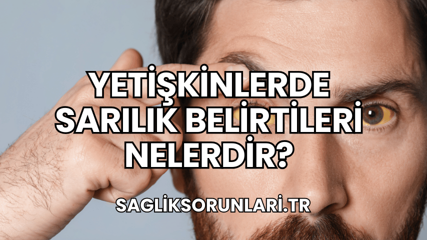 Yetişkinlerde Sarılık Belirtileri Nelerdir?