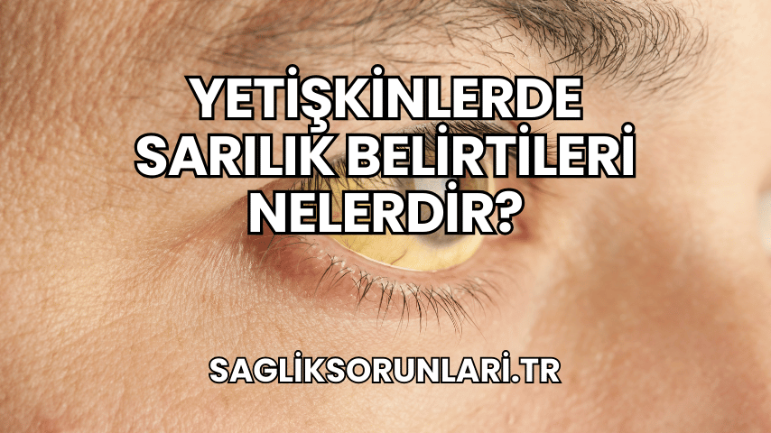 Yetişkinlerde Sarılık Belirtileri Nelerdir?