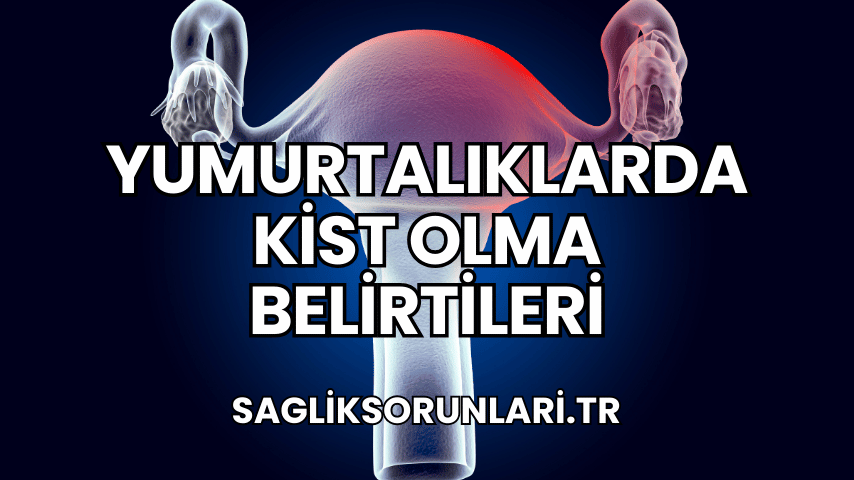 Yumurtalıklarda Kist Olma Belirtileri