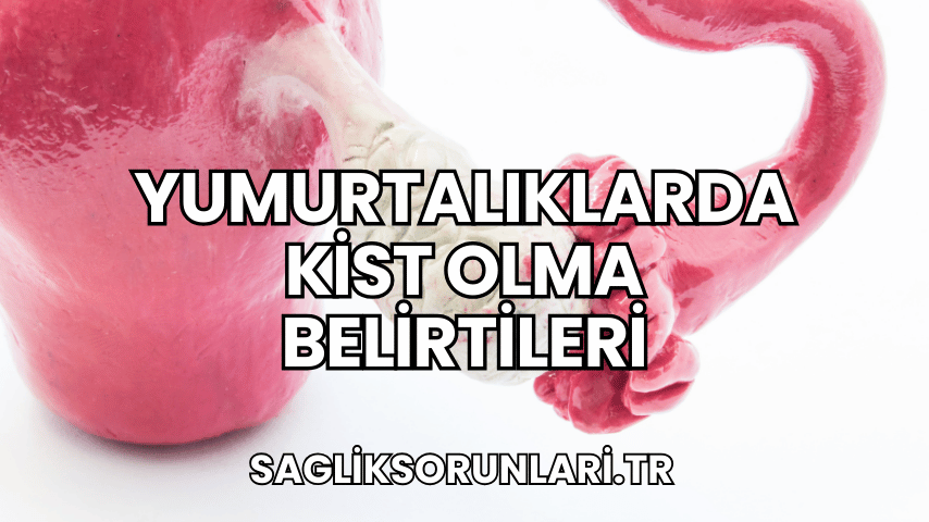 Yumurtalıklarda Kist Olma Belirtileri