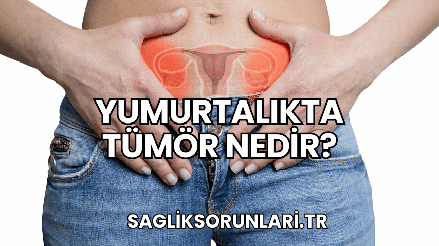 Yumurtalıkta Tümör Nedir?