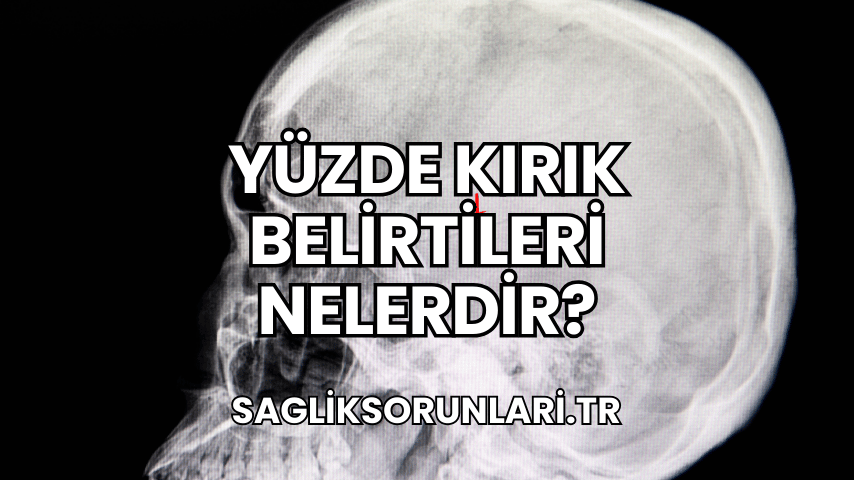 Yüzde Kırık Belirtileri Nelerdir?