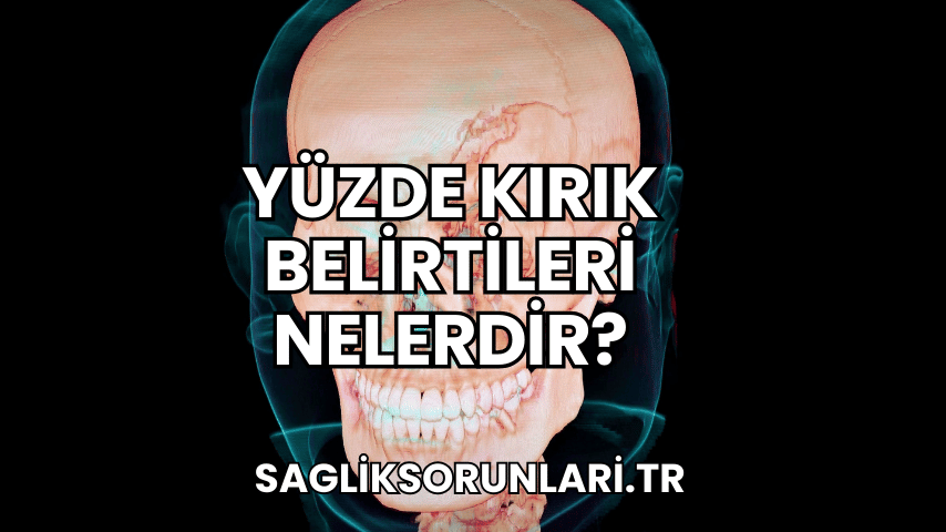 Yüzde Kırık Belirtileri Nelerdir?