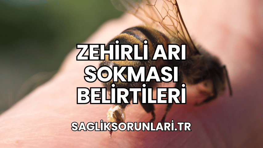 Zehirli Arı Sokması Belirtileri