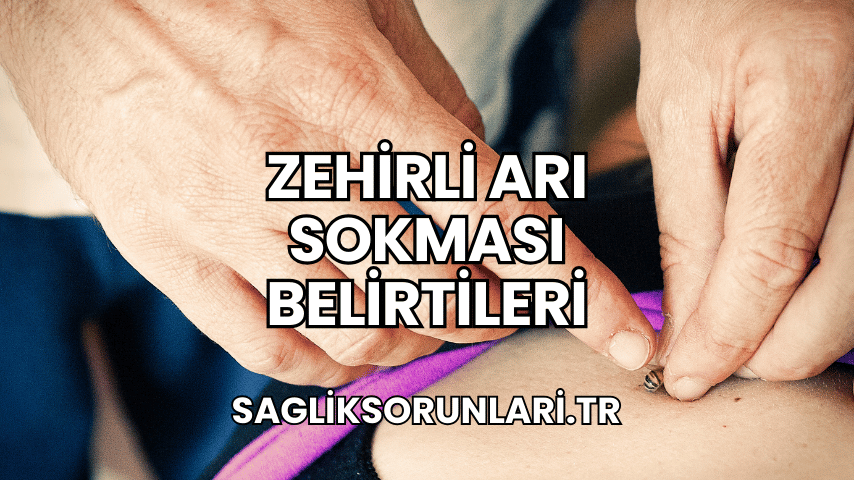 Zehirli Arı Sokması Belirtileri