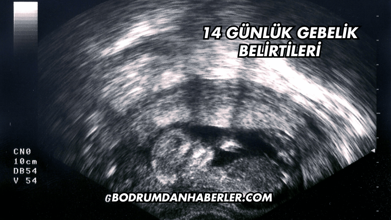 14 Günlük Gebelik Belirtileri