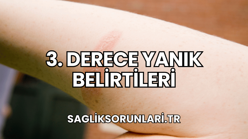 3. Derece Yanık Belirtileri