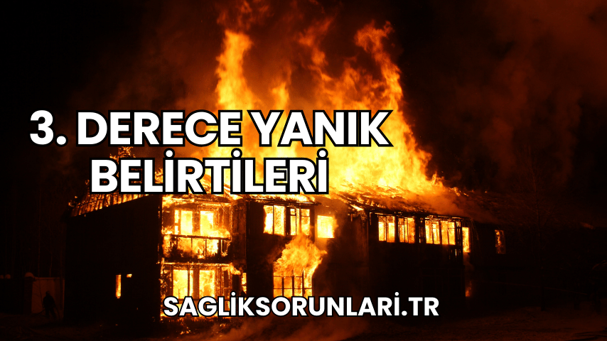 3. Derece Yanık Belirtileri