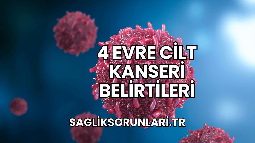 4 Evre Cilt Kanseri Belirtileri